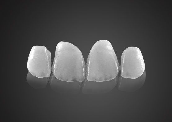 IPS 0.2mm Ultra Thin Emax Veneers Ανθεκτικές στις λεκέδες με υψηλή αντοχή