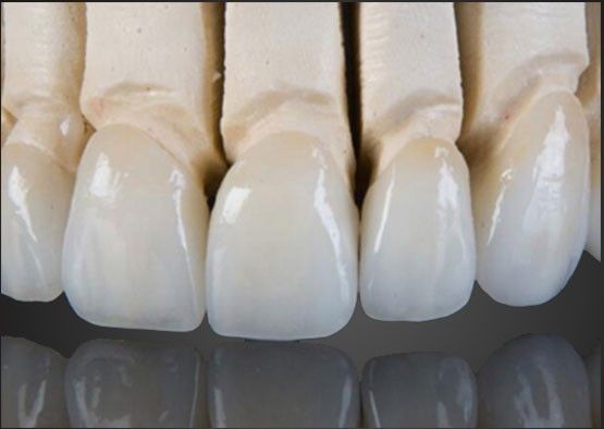 Wieland Zirconia All Ceramic Crown εσωτερική ζωγραφική προσαρμοσμένη με σχεδιασμό CAD