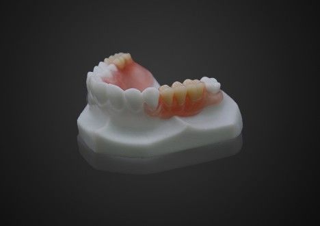 Ελαφρύς όγκος άνετος Valplast μερική οδοντοστοιχία εύκολο καθαρισμό υψηλή διαφάνεια