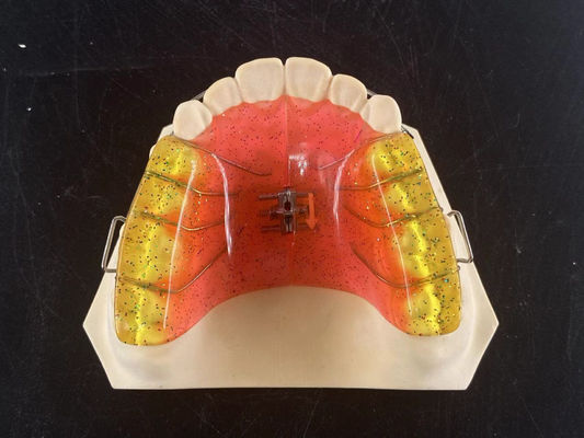 Προσαρμοσμένο 2 Ways Dental Arch Expander Προσαρμόσιμο Ορθοδοντικό Εργαλείο